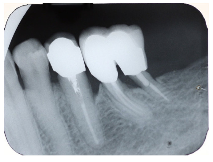 Figure 19