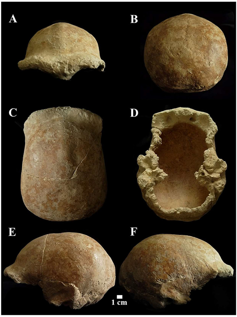 Figure 11