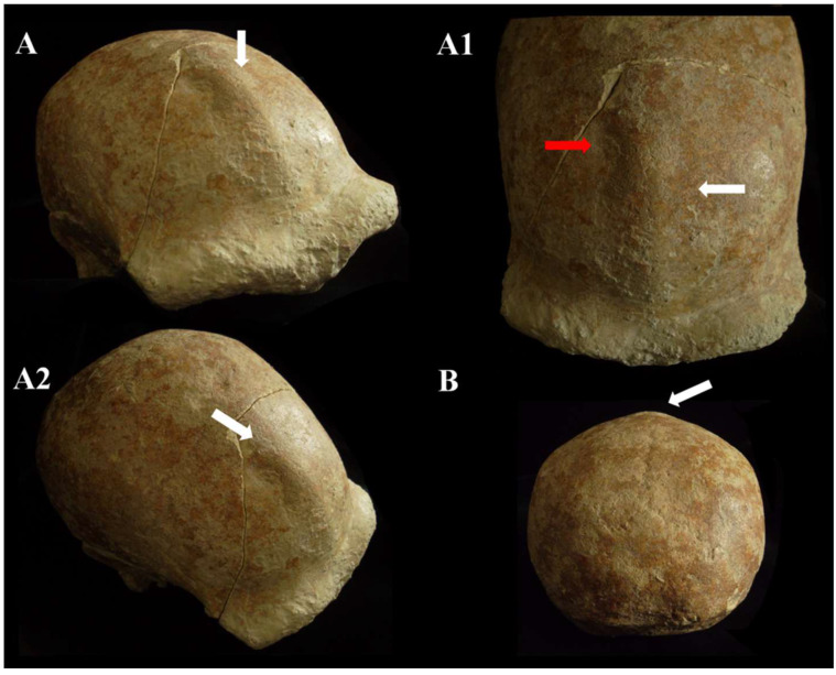 Figure 12