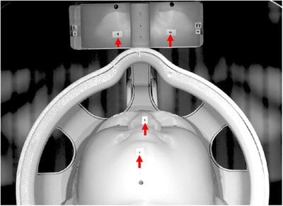 FIGURE 2