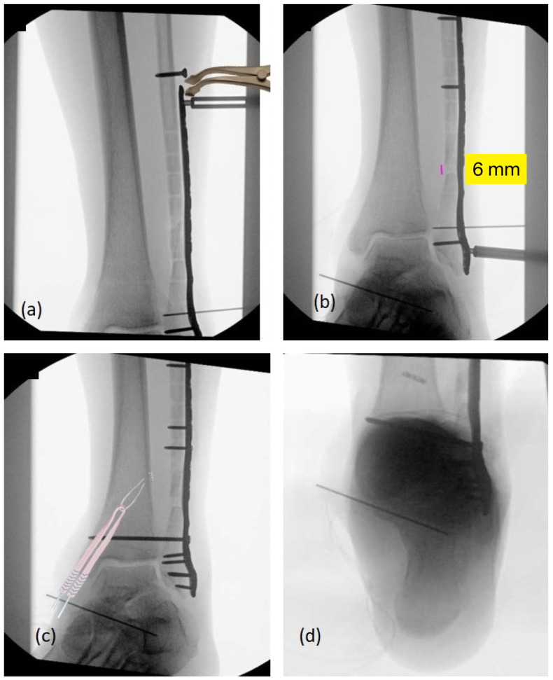Figure 7