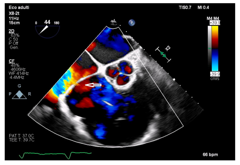 Figure 4