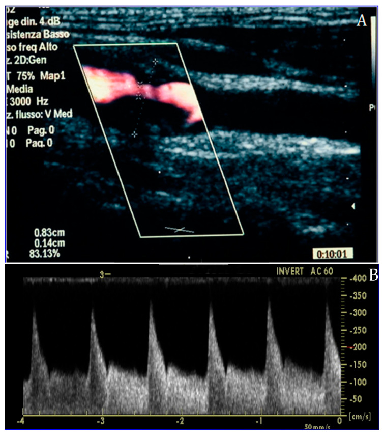 Figure 2