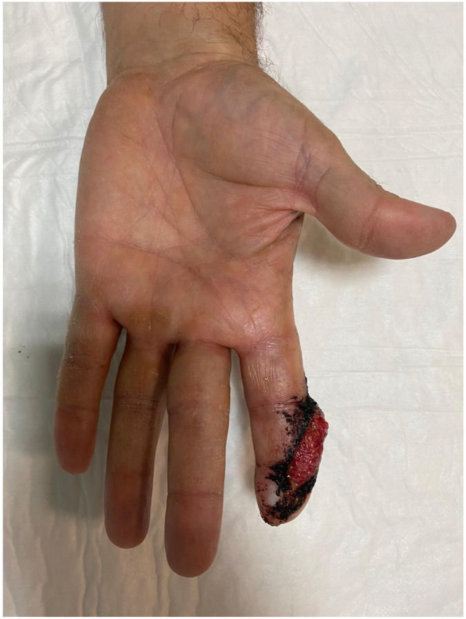 Figure 11
