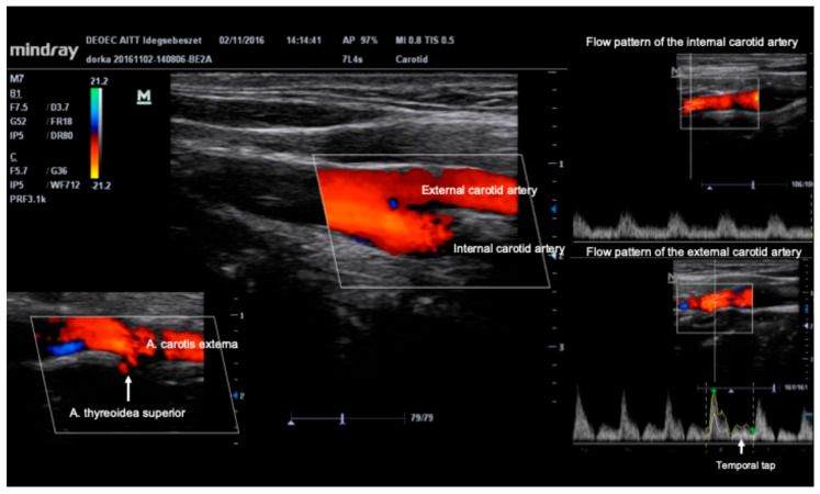 Figure 6