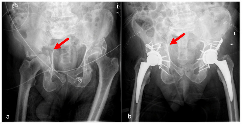 Figure 6