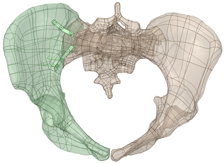 Figure 4