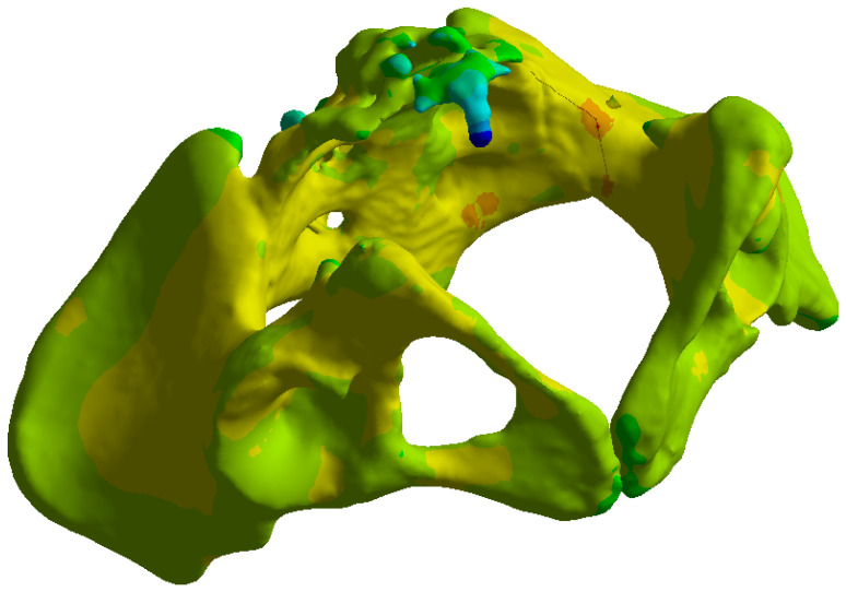 Figure 11