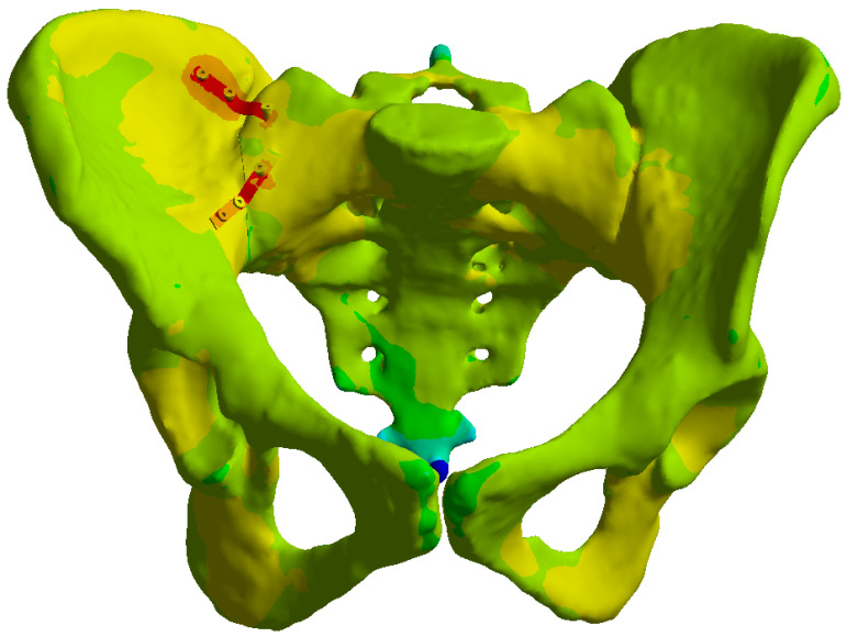 Figure 14