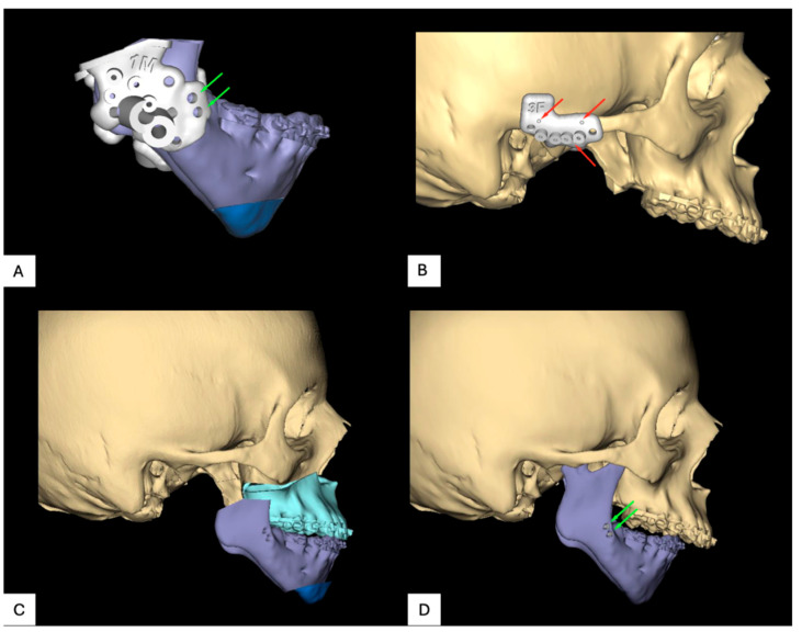 Figure 6
