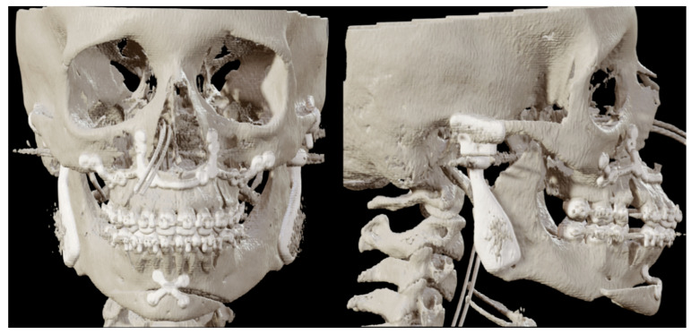 Figure 11