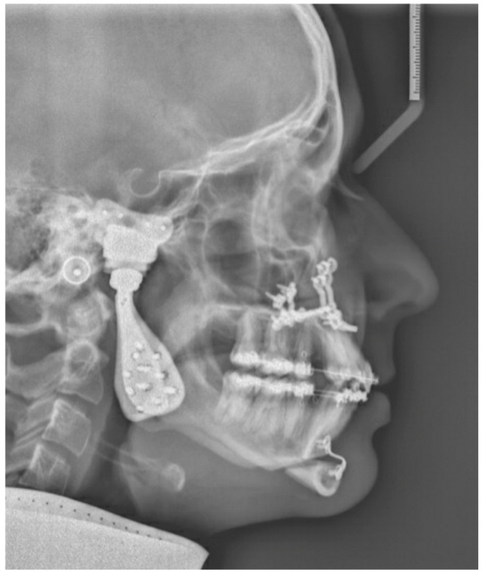 Figure 12