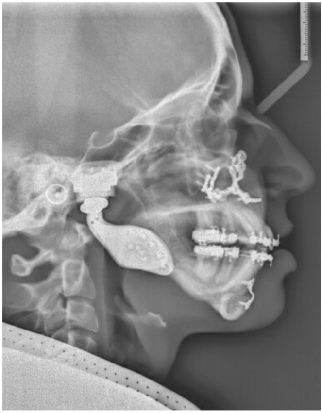 Figure 14