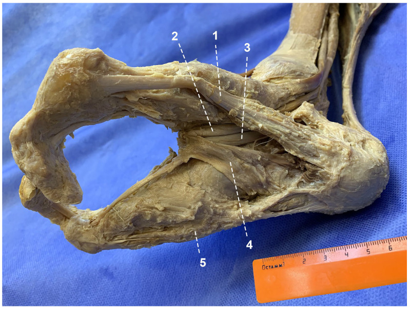 Figure 4