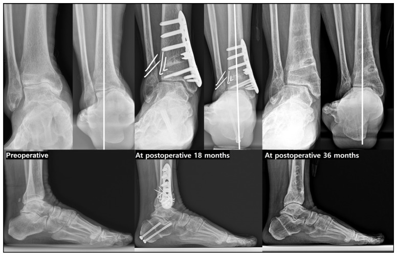 Figure 11