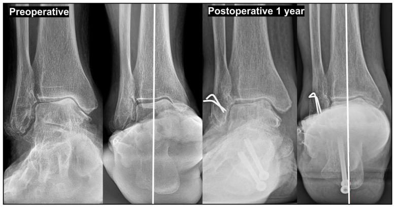 Figure 12