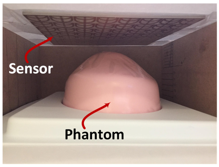 Figure 17