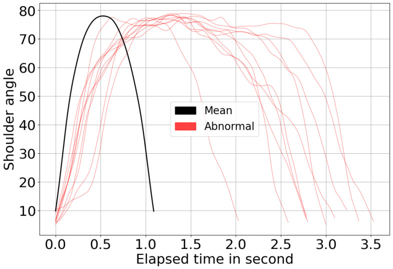 Figure 15