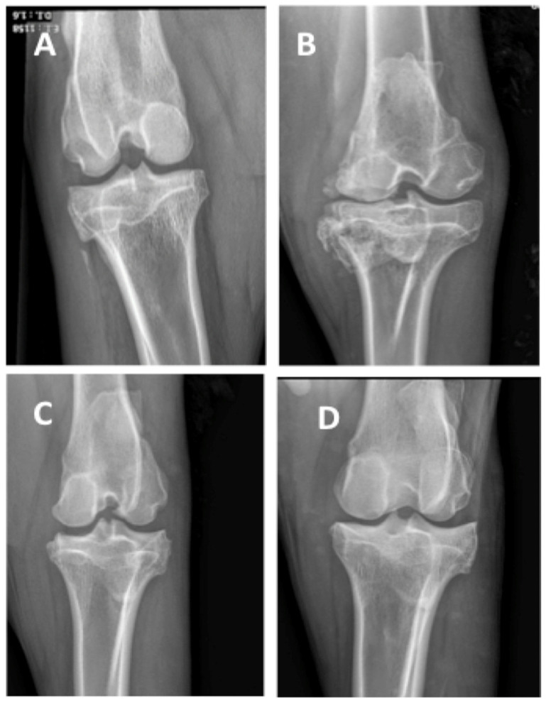 Figure 11
