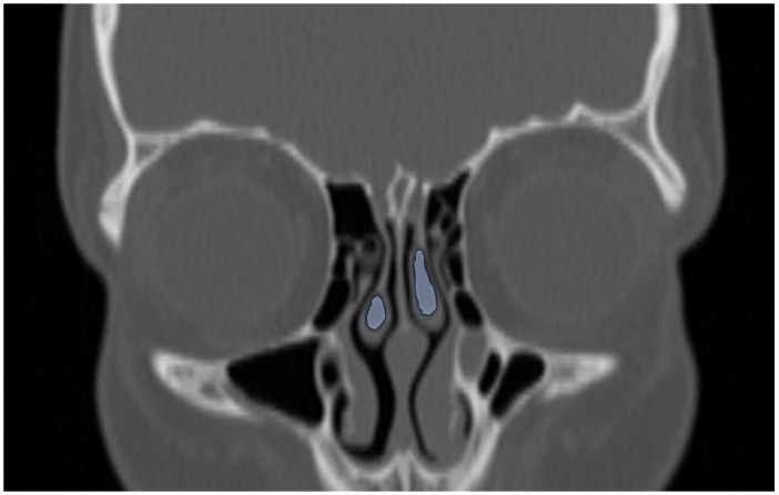 Figure 7