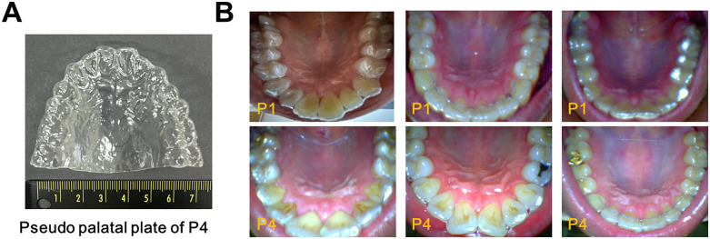 Fig 2