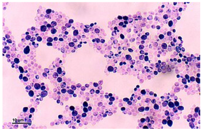 Figure 14