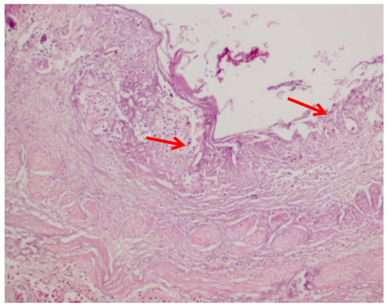 Figure 17