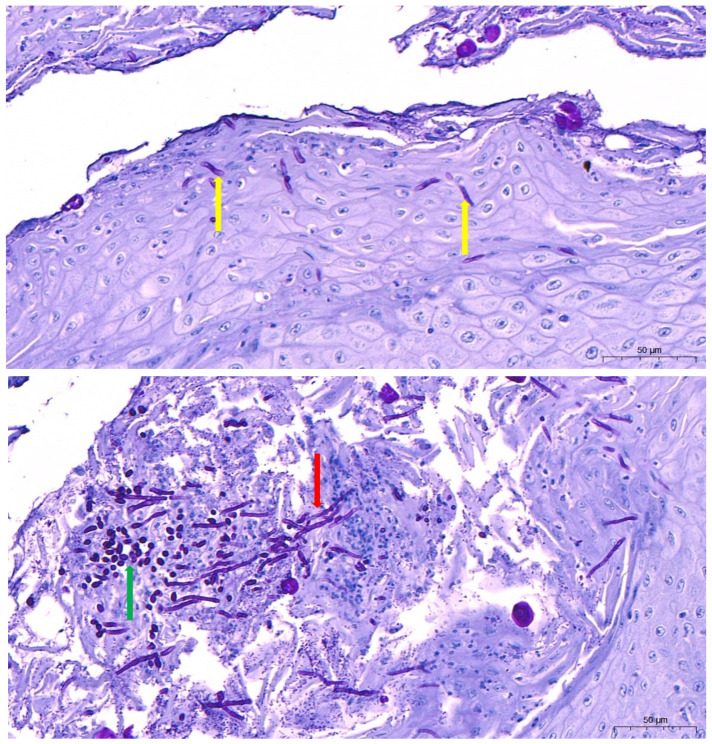 Figure 18