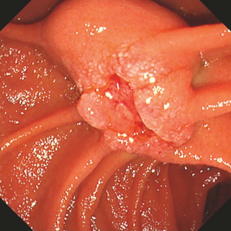 Fig. 2