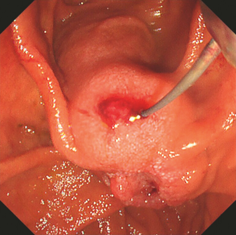 Fig. 4