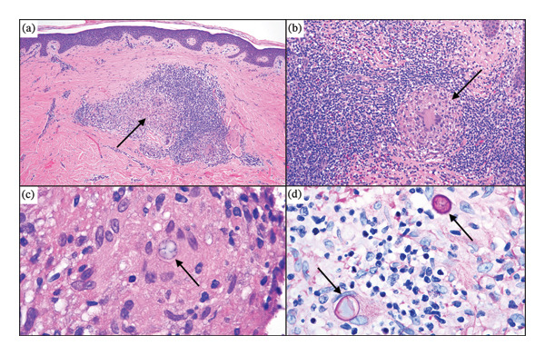 FIGURE 2