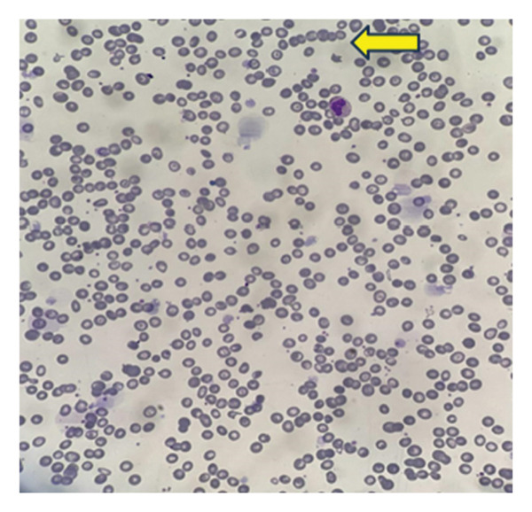 FIGURE 4