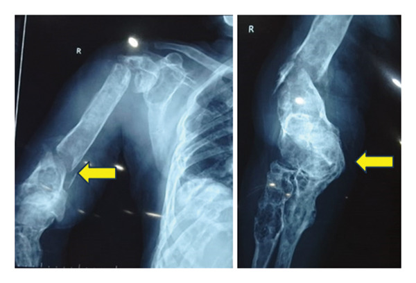 FIGURE 3