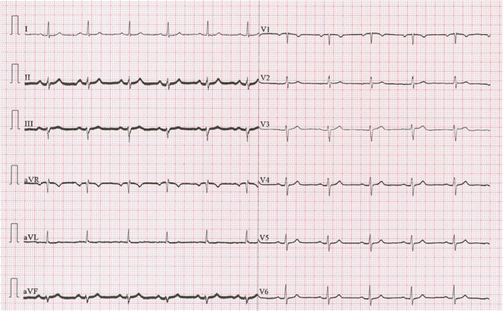 FIGURE 1