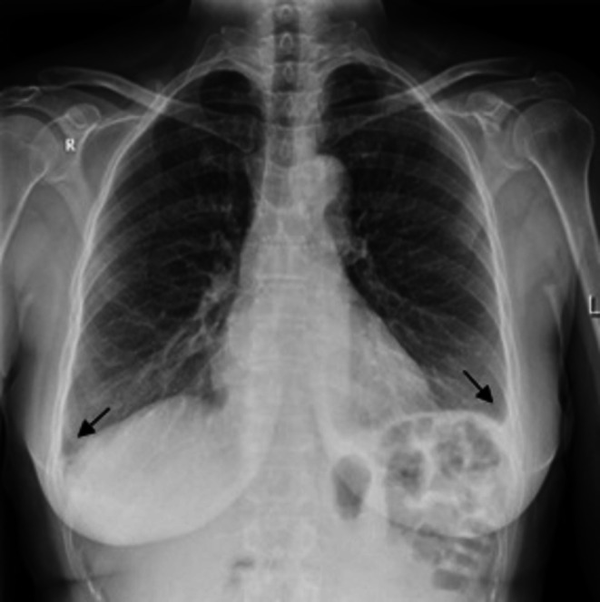 FIGURE 2
