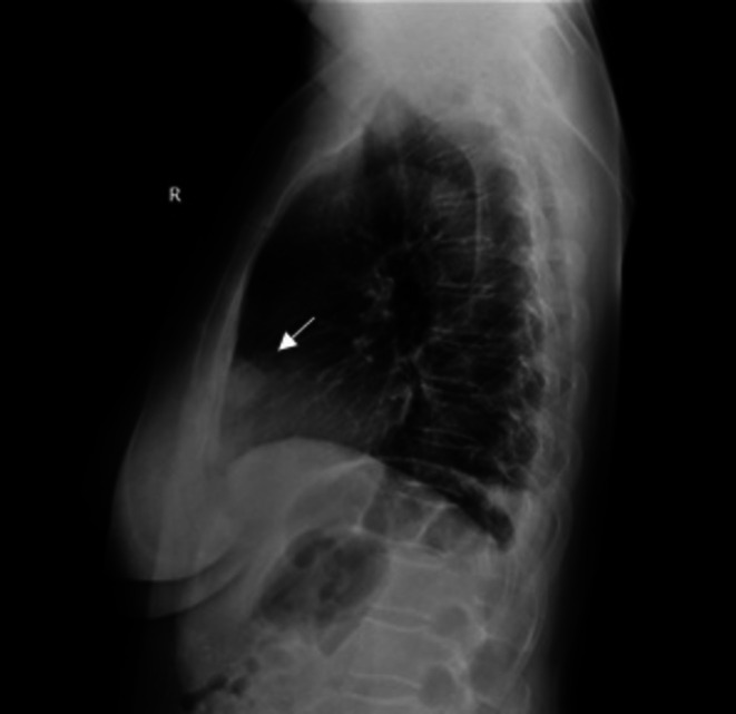 FIGURE 3
