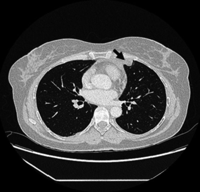 FIGURE 4