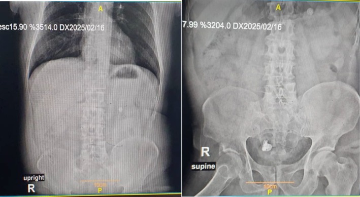 FIGURE 1