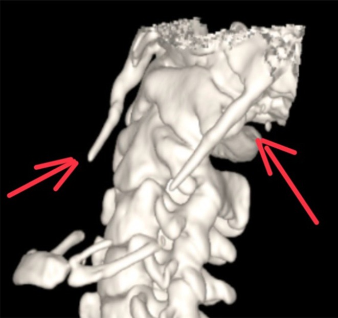 FIGURE 2