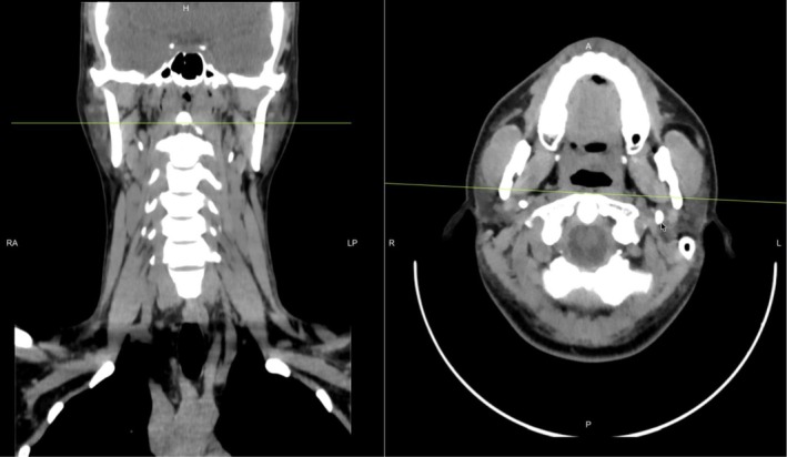 FIGURE 1