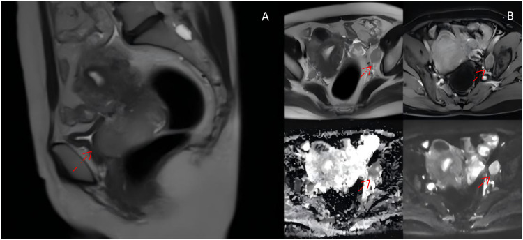 Figure 1