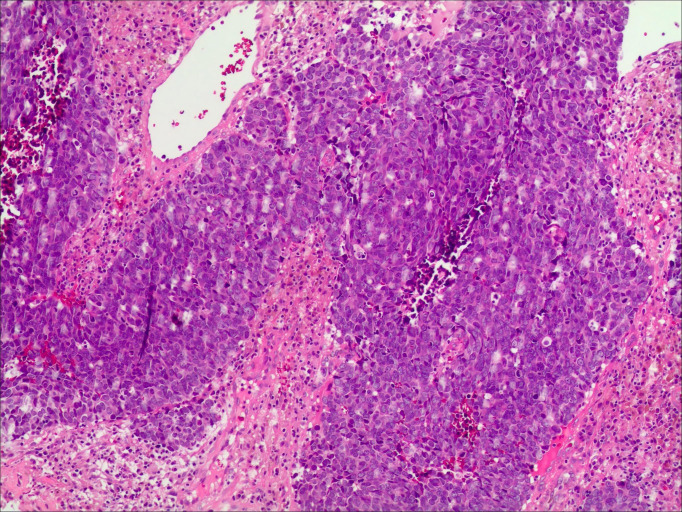 Figure 2