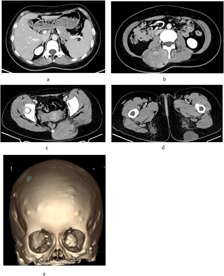Figure 4