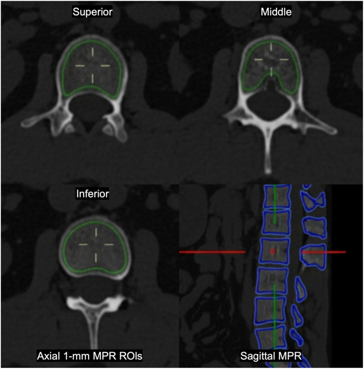Figure 1