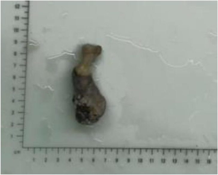Figure 3