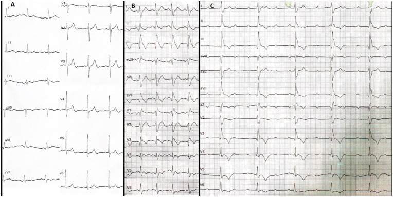 Figure 1