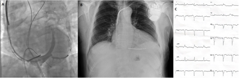 Figure 3