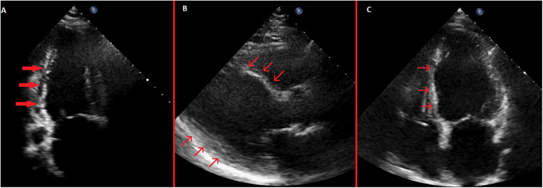 Figure 4