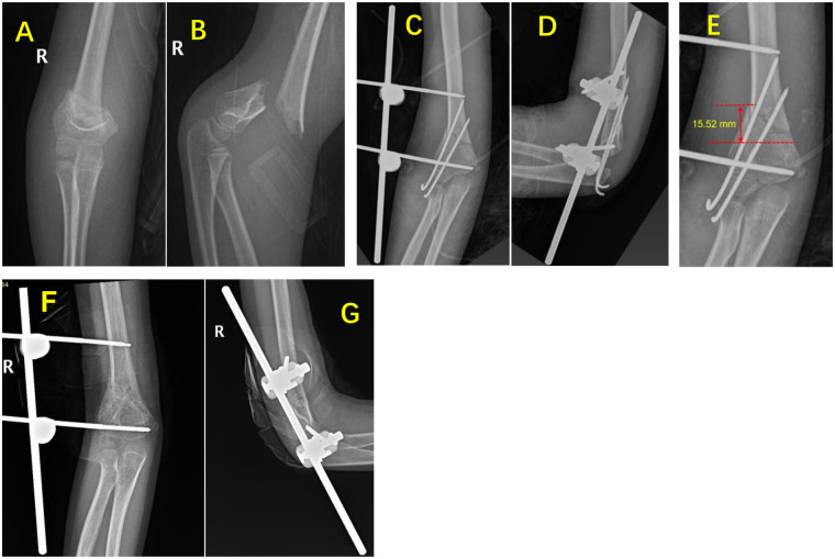 Figure 2