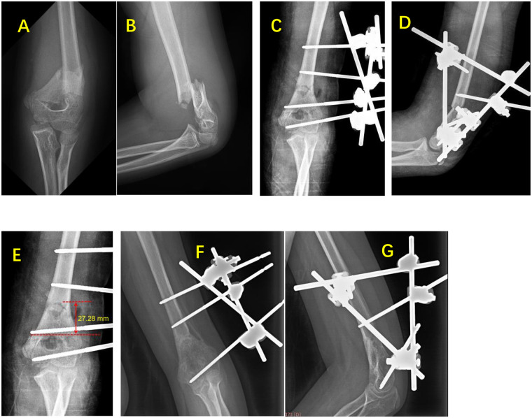 Figure 3